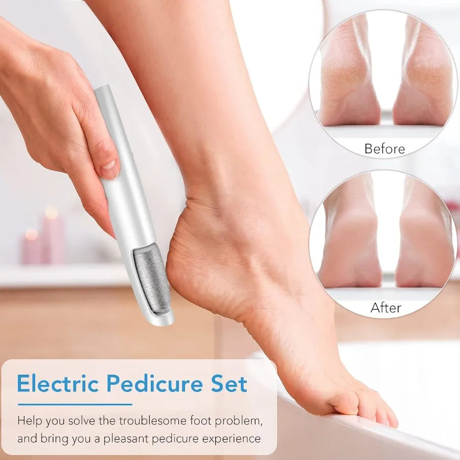 Callus Remove for Diabetic Foot - The Safest & Effective Callus Solution for Diabetic Foot!