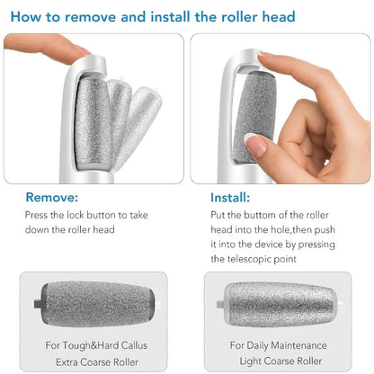 Callus Remove for Diabetic Foot  - The Safest & Effective Callus Solution for Diabetic Foot!